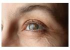 Effective Glaucoma Treatment in Bardhaman by Expert Eye Specialists