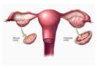 Top Fertility Hospitals -  Best IVF Doctors in Bangalore - 
