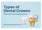 Types of Dental Crowns: An Option According to Your Needs