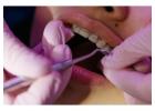 Affordable Dental Braces in Newtown Kolkata