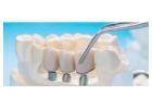 Get Emergency Dental Implants in NJ Fast
