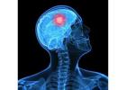 Best Neurosurgery Hospital in Chennai | Expert Neurosurgeon