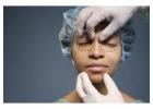 Expert Rhinoplasty in Lucknow by Dr. Sumit Malhotra