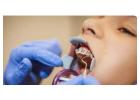 Best Orthodontist in Abu Dhabi