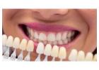 Best Dental Clinic in Abu Dhabi | Dental Clinic Baniyas