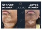 Side Effect-Free Vitiligo Treatment – Laxmi Vitiligo Centre, Madurai