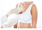 Breast Augmentation Treatment in Delhi | Expert Breast Implants in Delhi – Dr. Mrinalini Sharma
