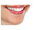 Brighten Your Smile with Teeth Whitening Treatment in NJ