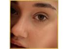  Eyelid Surgery in Los Angeles