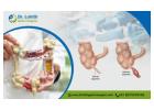 Best Laparoscopic Appendix Surgery in Bangalore - Dr. Lohith U