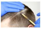 Exogrow Hair Treatment