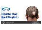 Alopecia Theek Hone Mein Kitane Din Lagate Hain