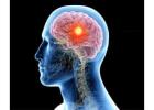 Best Neurosurgeon in Delhi/Ncr