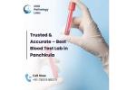 Trusted & Accurate – Best Blood Test Lab in Panchkula