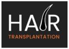 Hair Loss Treatments for Men | Male Hair Loss Treatment