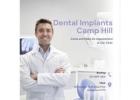 Secure Your Smile with Dental Implants Camp Hill – Norman Park Dental Surgery