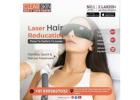 best vascular laser treatment in india