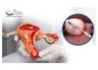 Best Myomectomy Surgery in Whitefield by Dr. Aneeta Talwar