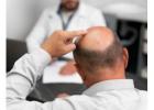 Best Hair Transplant Clinics in Varanasi with Affordable Cost