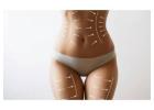 Tips to Maintain Better Results After Liposuction