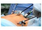 Expert Laparoscopic Surgeon in Ahmedabad – Dr. Jigar Patel