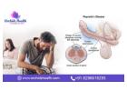 Effective Penile Curvature Treatment at Orchidz Health