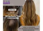 “Bring Back Your Confidence with Instant Hair Fixing”