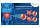 Best Treatment for Inflammatory Bowel Disease in Sarjapur Road - Dr. Lohith U