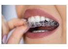 Invisalign Dental Implants – Cura Dental Cliffside Park