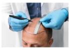 Hair Treatment & Specialist In Prayagraj – Hair Aesthetica