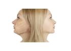 Personalized Double Chin Treatment in Delhi by Skin Experts