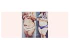 How Abdominoplasty Helps Flatten Your Tummy?