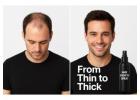 Stop Hair Loss & Regrow Naturally – Hair Growth Spray with Fast Results