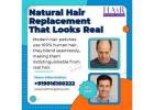 Hair Fixing Zone | Professional Hair Patches Services Bangalore 