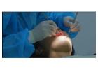 Trusted Emergency Dentist St Louis for Immediate and Reliable Dental Care by Stallings Dental