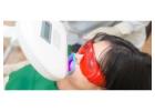 Brighten Your Smile with Trusted Teeth Whitening Dentist Singapore