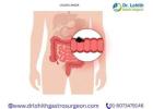 Best Laparoscopic Colon Cancer Surgery in Bangalore - Dr. Lohith U