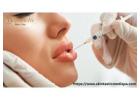 Enhance Natural Beauty with Best Lip Fillers Riverside 