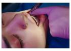 Custom-Fit Orthodontic Retainers for Replacement in Charlotte, NC