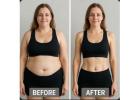 Looking for the Best Slimming Treatment in Thane? Visit DNA Royal Aesthetic Clinic.