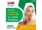 best vbeam laser treatment in india