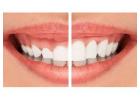 Top Dentist in Gurgaon – Ministry of Smile for Complete Dental Care
