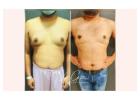 How to Lose Pectoral Fat in Men?