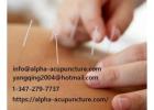 Cupping therapy in New York