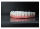 Full Mouth Dental Implants in Mexico with Teeth Savers