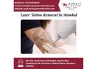 Laser Tattoo Removal in Mumbai | Harley’s Cosmetic Clinic with Dr. Sumit