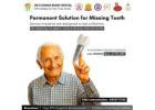 Immediate Loading Dental Implants in Nellore – Fixed Teeth in 24 Hours