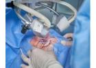 Best Cataract Surgery in Howrah for Clear Vision  