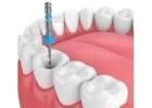 Painless Root Canal Treatment in Newtown