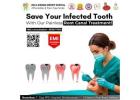 Best Rotary Root Canal Treatment in Nellore